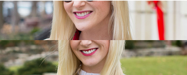 Before After Teeth