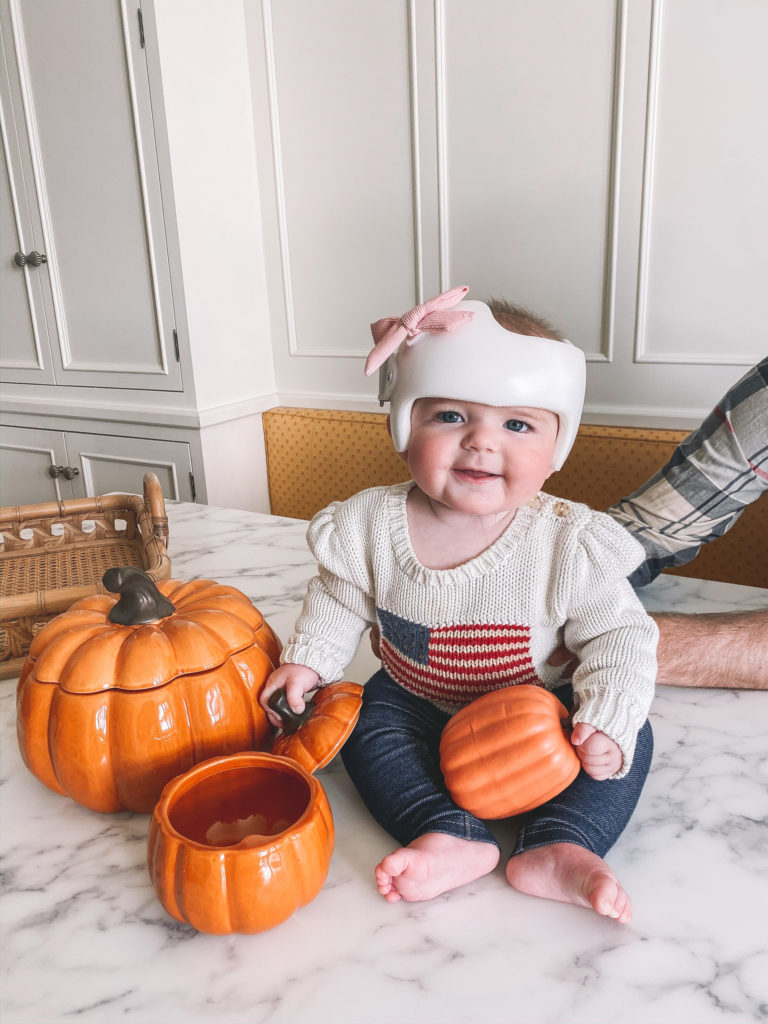 Cranial Helmet and Plagiocephaly: Lucy Update | Kelly in the City