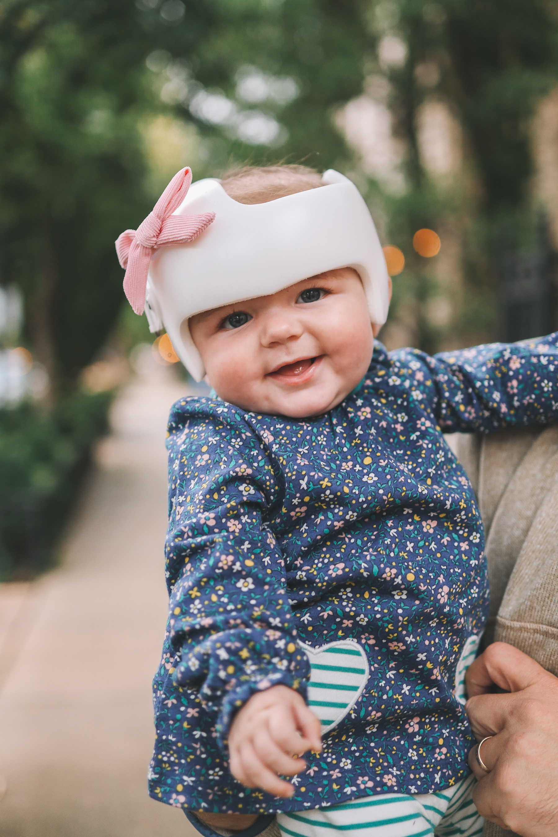 Baby head deals helmet cost